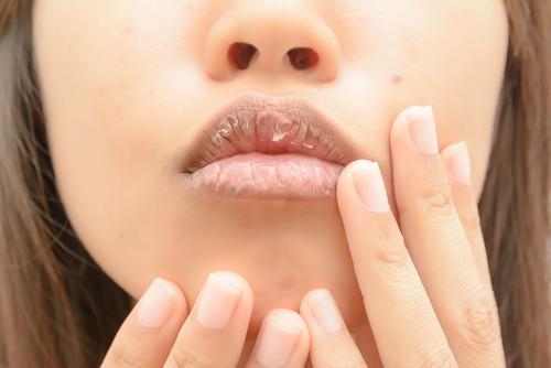 如何预防春季唇炎、唇干、唇裂？春季唇部护肤方法大总结！