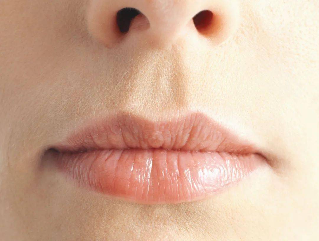 秋冬季节慢性唇炎来袭，专家释疑唇部为何越舔越干