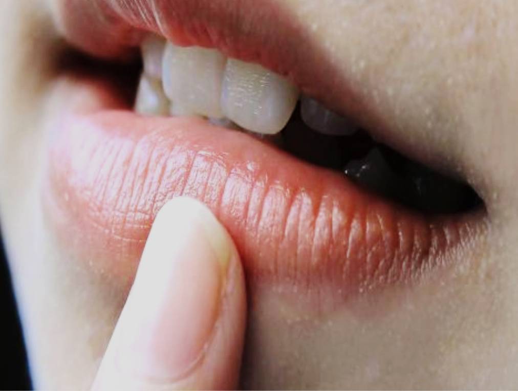如何保养你的嘴唇： 每天基本保养唇部护理