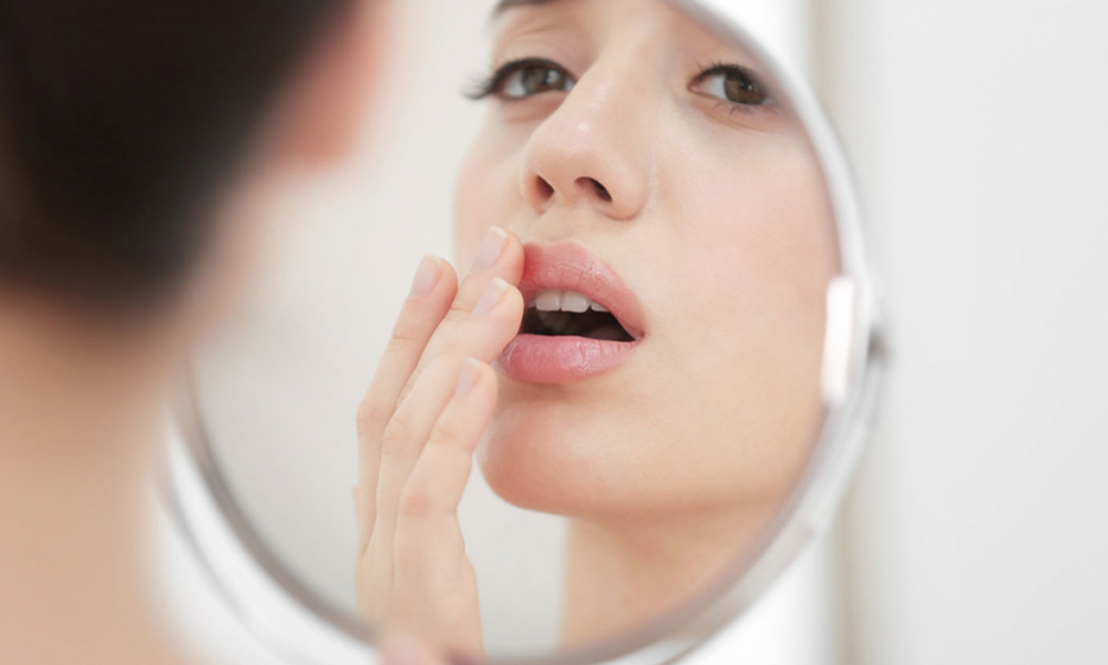 检测你是否患上唇炎？
