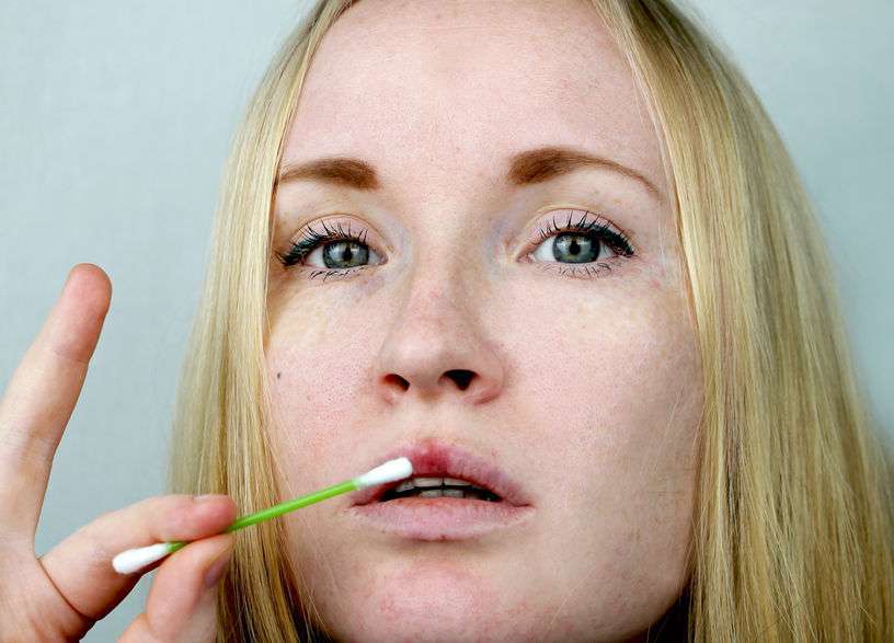 过敏性唇炎症状都有哪些？平时应该怎么注意？这些事情你需知道