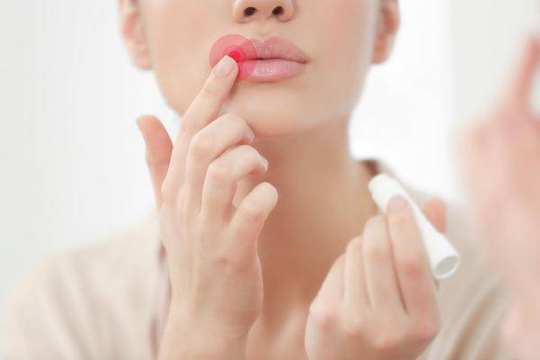 引起唇炎的原因有哪些？这六大诱因要了解